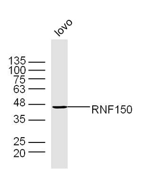 RNF150 Rabbit Polyclonal Antibody