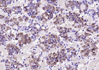 PRL Mouse Monoclonal Antibody