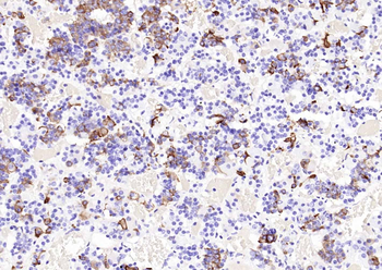 PRL Mouse Monoclonal Antibody