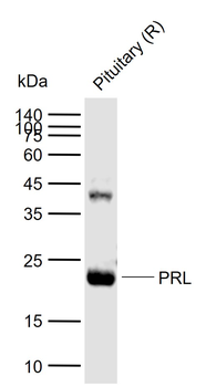 PRL Mouse Monoclonal Antibody
