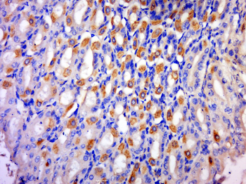 RNF156 Rabbit Polyclonal Antibody