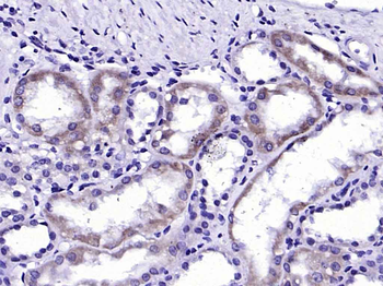 ALAS1 Rabbit Polyclonal Antibody