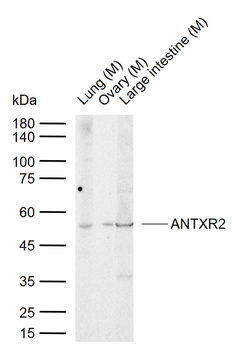 ANTXR2 Rabbit Polyclonal Antibody