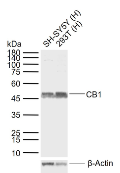 CNR1 Rabbit Polyclonal Antibody
