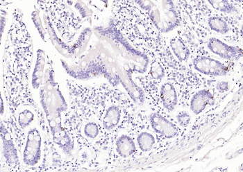 TIMP1 Mouse Monoclonal Antibody