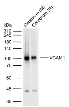 VCAM1 Recombinant Rabbit Monoclonal Antibody