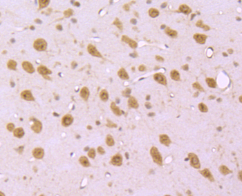 EDG1 Recombinant Rabbit Monoclonal Antibody
