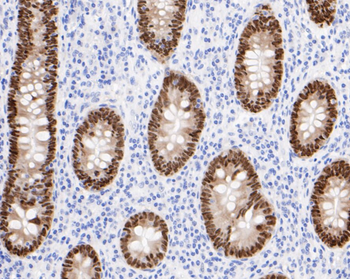 CDX2 Recombinant Rabbit Monoclonal Antibody