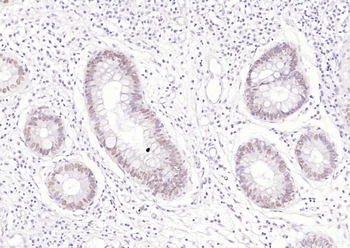 CDX2 Recombinant Rabbit Monoclonal Antibody