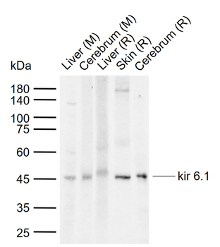 Kir 6.1 Rabbit Polyclonal Antibody
