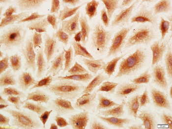 PRR15 Rabbit Polyclonal Antibody