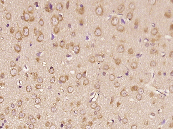 RNF170 Rabbit Polyclonal Antibody