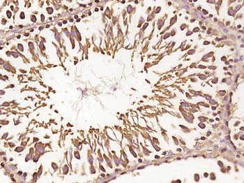 RNF170 Rabbit Polyclonal Antibody