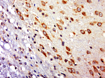 RNF10 Rabbit Polyclonal Antibody