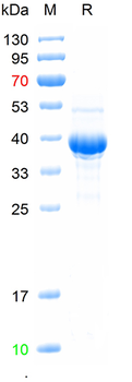 Recombinant human PRCP protein, N-His