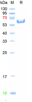 Recombinant human POLK protein, C-His