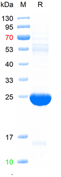 Recombinant human CDK2 protein, C-His