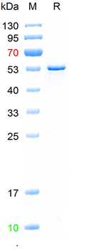 Recombinant human NFL protein, N-His