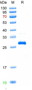 Recombinant human PIK3CD protein, His