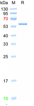 Recombinant Rabies virus N protein, N-His