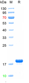 Recombinant human ACOT13 protein, N-His