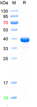 Recombinant human ATP1A1 protein, His