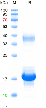 Recombinant human CIDEB protein, C-His