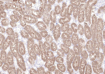 SOD1 Recombinant Rabbit Monoclonal Antibody