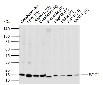 SOD1 Recombinant Rabbit Monoclonal Antibody