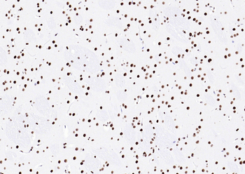 TARDBP Recombinant Rabbit Monoclonal Antibody