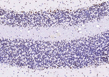 TARDBP Recombinant Rabbit Monoclonal Antibody
