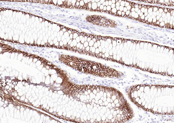 GPA33 Recombinant Rabbit Monoclonal Antibody