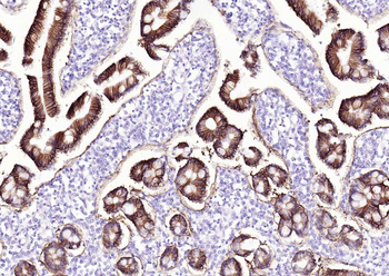 GPA33 Recombinant Rabbit Monoclonal Antibody