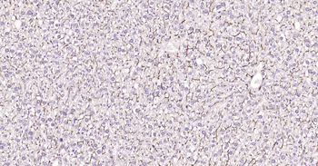 P Glycoprotein Recombinant Rabbit Monoclonal Antibody
