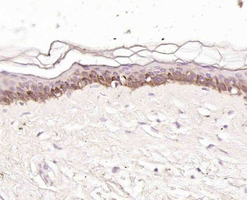 Keratin 14 Recombinant Rabbit Monoclonal Antibody