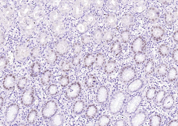 MCM7 Recombinant Rabbit Monoclonal Antibody