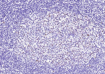 MCM7 Recombinant Rabbit Monoclonal Antibody
