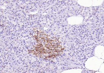 CD99 Recombinant Rabbit Monoclonal Antibody