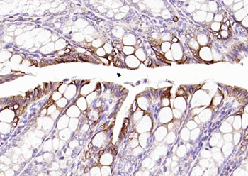 Cytokeratin 20 Mouse Monoclonal Antibody