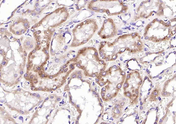 NAPSIN A Mouse Monoclonal Antibody