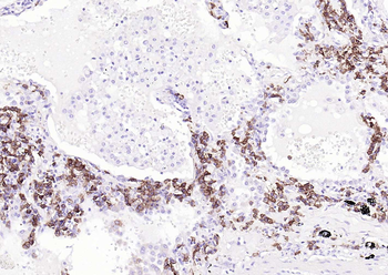 CD38 Mouse Monoclonal Antibody