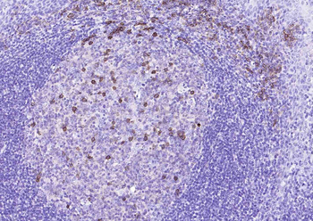 CD38 Mouse Monoclonal Antibody