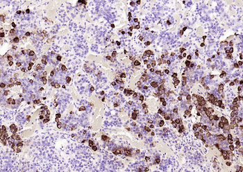 ACTH Mouse Monoclonal Antibody