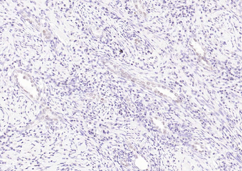 MLH1 Mouse Monoclonal Antibody
