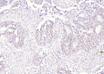 MLH1 Mouse Monoclonal Antibody
