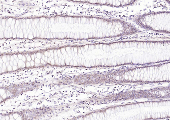 MLH1 Mouse Monoclonal Antibody