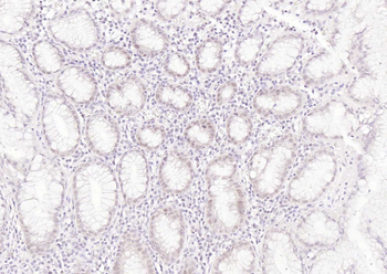 MLH1 Mouse Monoclonal Antibody