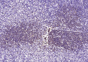 OCT2 Mouse Monoclonal Antibody