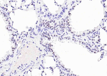 TTF1/NKX2-1 Mouse Monoclonal Antibody