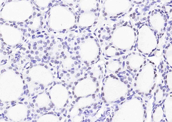 TTF1/NKX2-1 Mouse Monoclonal Antibody